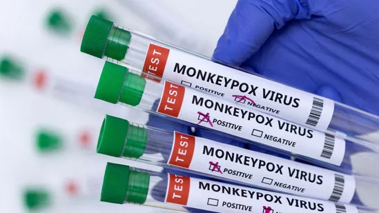 Can monkeypox spread through sex? What experts say